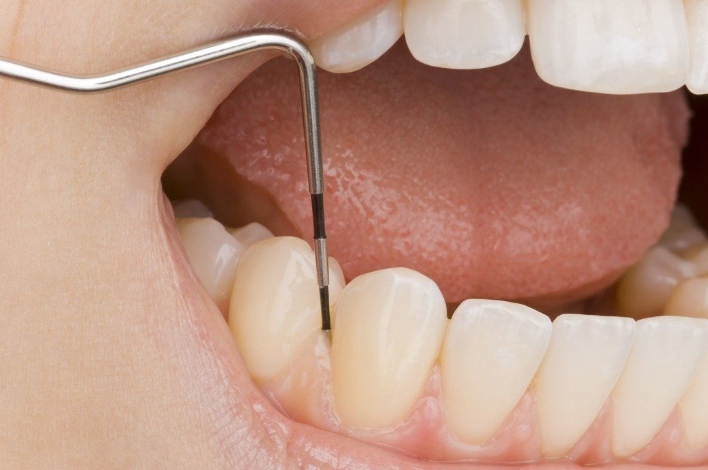 Endodontie-1
