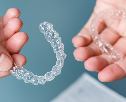 Gros plan sur des mains tenant des aligneurs dentaires transparents, utilisés pour l'orthodontie invisible.