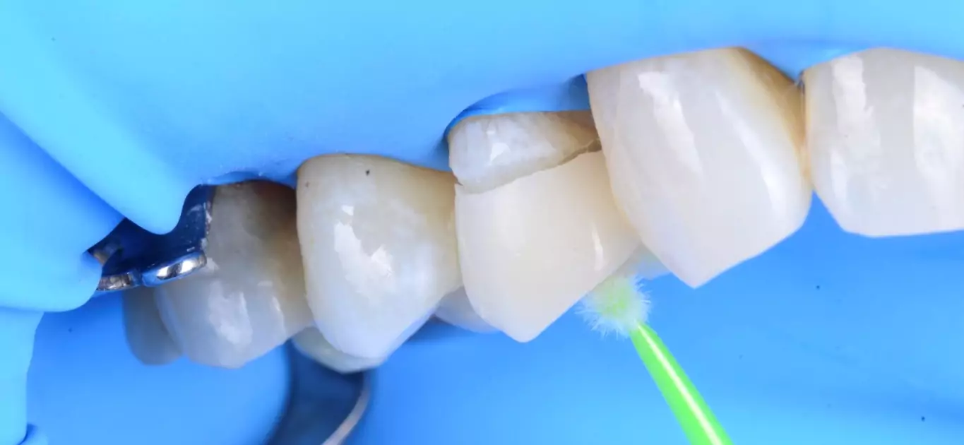 Dentisterie D1 Dental Concept 02